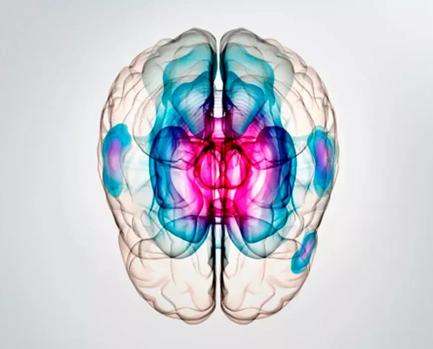 Oticon Brain Hearing